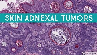 Skin Adnexal Tumors Dermatopathology Unknown Cases [upl. by Bay124]