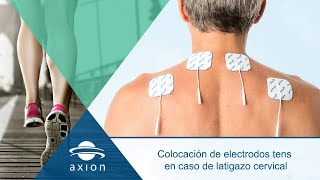 Colocación electrodos TENS para latigazo cervical  Electroestimulación TENS para terapia del dolor [upl. by Iniffit590]