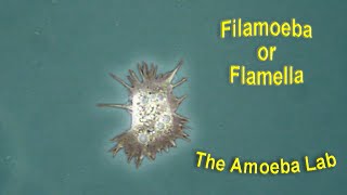 Amoeba  Filamoeba or Flamella  by the Amoeba Lab [upl. by Rodge]