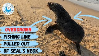 Overgrown Fishing Line Pulled Out of Seal’s Neck [upl. by Bokaj256]