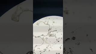 Zooplankton found in pond water biology microscopevideo [upl. by Toffey315]