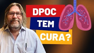 DPOC tem cura [upl. by Eldoree]