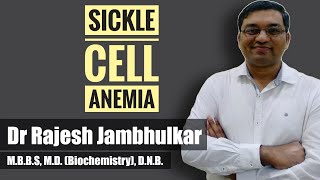 Sickle cell anemia [upl. by Akcinahs]