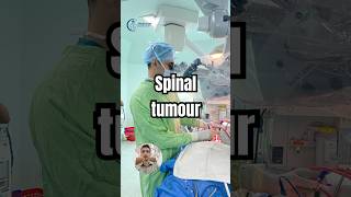 Spine tumour treatment  Cancer of spine treatment  Neurosurgeon [upl. by Siegler16]