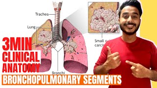 bronchopulmonary segments clinical anatomy  clinical anatomy of lungs anatomy [upl. by Skeie368]