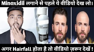 Watch Before Use Minoxidil Review Minoxidil hair regrowthMinoxidil Minoxidil on beardHaircare [upl. by Goodkin867]