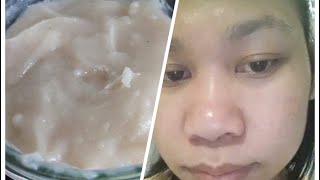 Natural Whitening Day Cream for younger looking skin  Acne Treatment  Pimple Treatment Whitening [upl. by Brawner954]