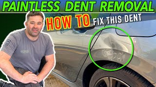 DENTS No Problem Watch the BEST Step by Step Guide On PDR [upl. by Drawe76]