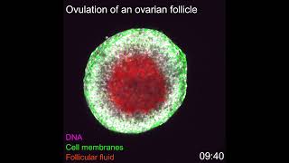 Eisprung erstmals von Anfang bis Ende gefilmt  Ovulation filmed from start to finish first time [upl. by Htebirol]