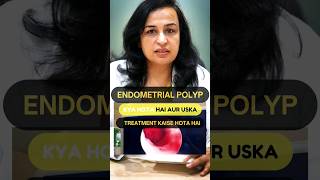 What is an Endometrial Polyp amp hows it treated  Endometrial Polyp in Hindi  Dr Nymphea Walecha [upl. by Nilrem541]