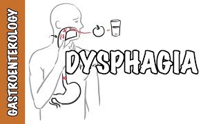 Approach to dysphagia difficulty swallowing  causes pathophysiology investigation [upl. by Yelad]