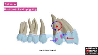 All you need to know about aligners amp attachments biomechanics part 2 [upl. by Byron]