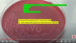 Lactose Fermenting and Nonlactose fermenting Colonies of Bacteria on Macconkey agar [upl. by Premer]