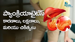 ప్యాంక్రియాటైటిస్ కారణాలు మరియు చికిత్సలు  Pancreatitis Treatment Options  Dr Bharath Kumar A [upl. by Bunde1]