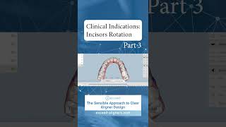 Clinical Indications Incisors Rotation Part 3 [upl. by Soigroeg]