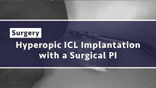 Hyperopic ICL Implantation with a Surgical PI [upl. by Natalya]