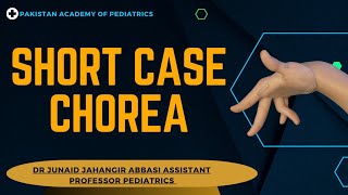 Short Case Chorea  Teaching on Patient [upl. by Palma331]