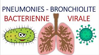 Comment différencier entre une pneumonie aigue communautaire bactérienne et virale atypique [upl. by Sowell]