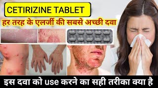 cetirizine hydrochloride tablets ip 10mg in hindi  Cetirizine tablets uses  Allergy Treatment [upl. by Derry291]