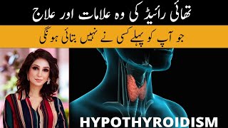 Hypothyroidism Symptoms amp Treatment In Urdu Hindi  Thyroid Ki Alamat Or Ilaj  Dr Sahar Chawla [upl. by Wiencke300]