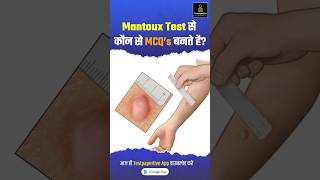 Mantoux Test क्या है और कैसे करते है  Tuberculin Skin Test Mantoux Test Results Reading shorts [upl. by Alayne270]