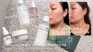 my holy grail korean skincare for calming acne amp healing my skin barrier  ANUA product review [upl. by Eniamsaj482]