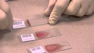 IDEXX  How to make a Blood Film in 3 steps [upl. by Rosio]