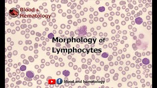 Morphology of Lymphocytes [upl. by Vierno]