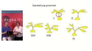 5 degea live  Pflege führt Regie  220519  Thema ERCP [upl. by Ettevey290]