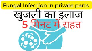 Fungal infection in private parts home remedy in Hindi [upl. by Cantlon]