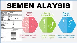 SEMEN ANALYSIS TEST IN HINDI SEMEN ANALYSIS TEST REPORT [upl. by Ahsenroc]