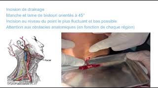 Incision de drainage [upl. by Elmira]