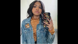 Navia Robinson transformation from 1 to 16 years old [upl. by Darn741]