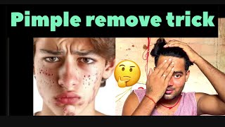 Pimple remove trick 🤔🤔😲😲part1 [upl. by Salhcin214]