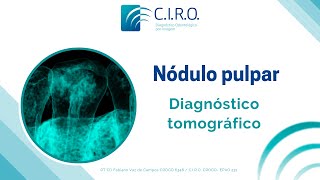 Diagnóstico tomográfico de nódulos pulpares [upl. by Barraza]