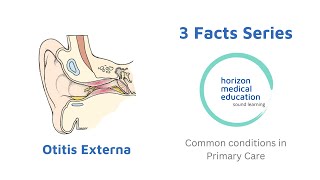 Otitis externa  ear symptoms  swimmers ear [upl. by Rik196]