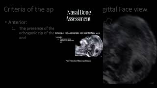 Perfect Midsagittal Fetal Face View in Ultrasound [upl. by Tann]