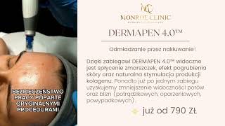 ZABIEG DERMAPEN 40 MONROE CLINIC KIELCE [upl. by Rebmik558]