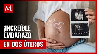 ¡Embarazo doble asombroso La increíble historia de Kelsey y sus bebés en dos úteros [upl. by Ennagem]