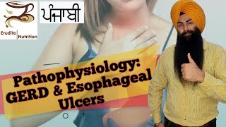 Pathophysiology of GERD amp Esophageal Ulcers Punjabi [upl. by Coray862]