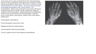 Charité Clinical Journal Club English by Fred Luft  09102019 [upl. by Hardi114]