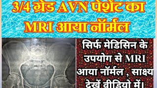 avn ka ayurvedic treatmentavn ka ilaj ayurveda avascularnecrosis [upl. by Dina]