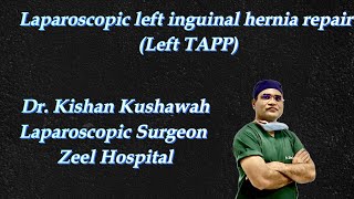 Laparoscopic left inguinal hernia repair with 3D mesh Left TAPP [upl. by Agiaf]