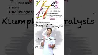 “Understanding Klumpke’s Paralysis Causes Injuries and Clinical Conditions Explained” [upl. by Esilrac986]