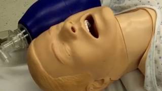 Tracheal intubation fiberopticassisted [upl. by Photima]