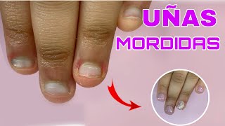 UÑAS MORDIDAS  Onicofagía  Reconstrucción de uña con acrílico  Jaayart [upl. by Ardenia587]