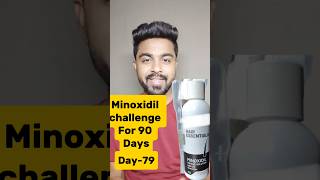 Minoxidil challenge For 90 daysDay79 minoxidil hairfall viralreels viralshort haircare hair [upl. by Aed]