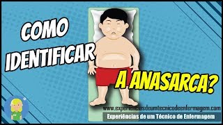 Como Identificar a Anasarca [upl. by Tooley]