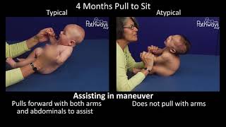 4 Month Old Baby Typical amp Atypical Development Side by Side [upl. by Grant143]