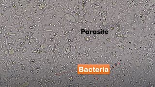 Bacteria and Parasites in stool Microscopy Live motile bacteria and cysts of Giardia lamblia [upl. by Llewol]